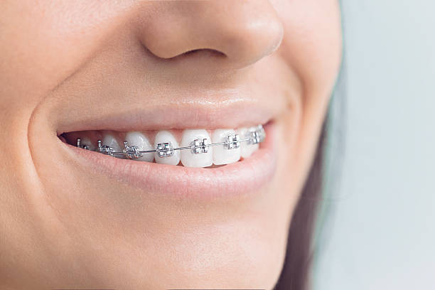 Best Veneers and Lumineers  in New Braunfels, TX